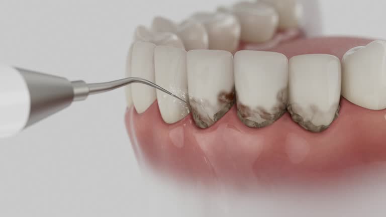Reliable Dental Implants contractor in Crete, IL by Smile Center Dentistry